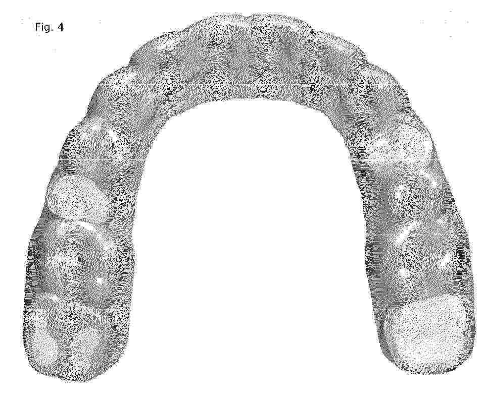 EP_4792772_PA