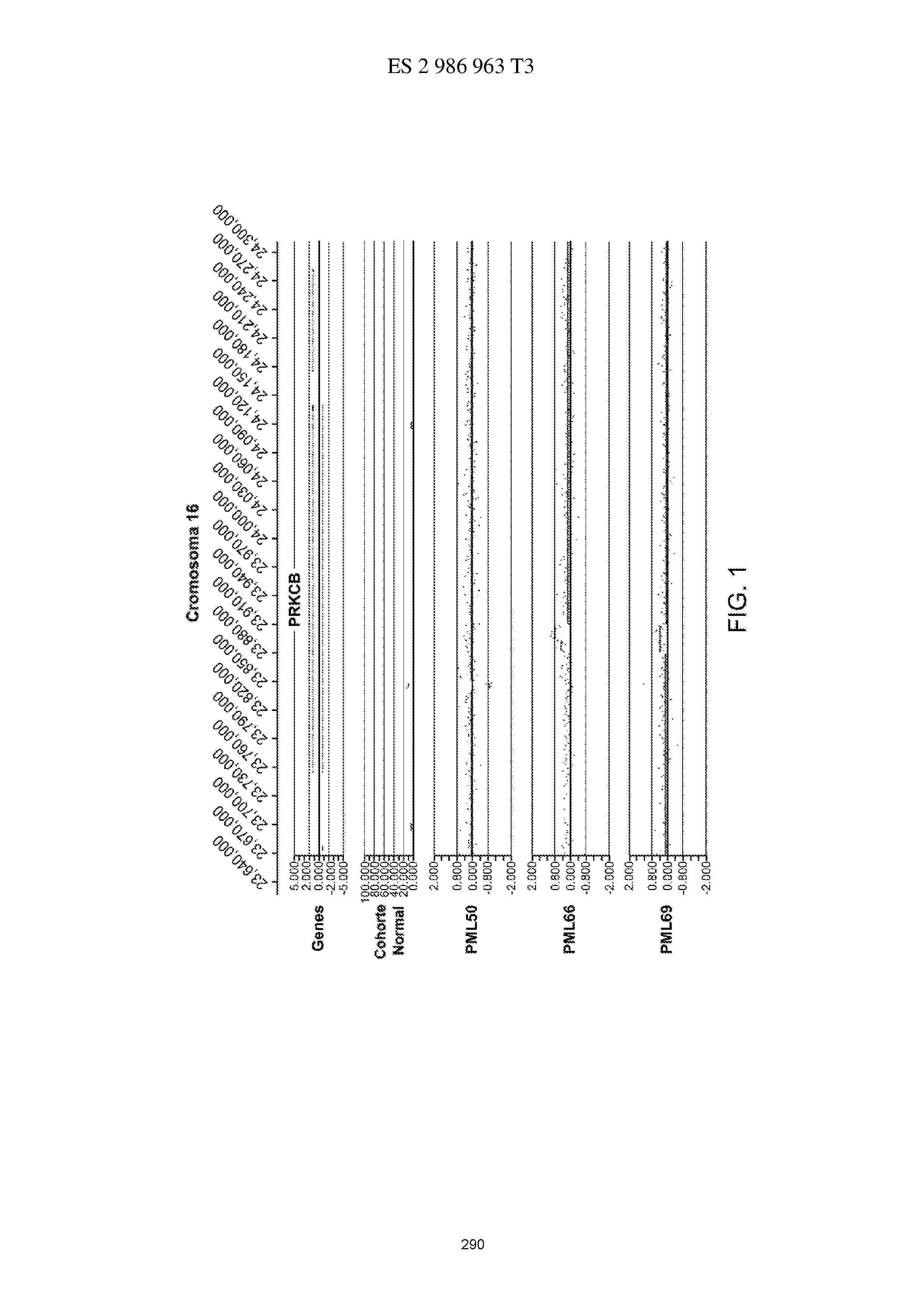ES_2986963_T3