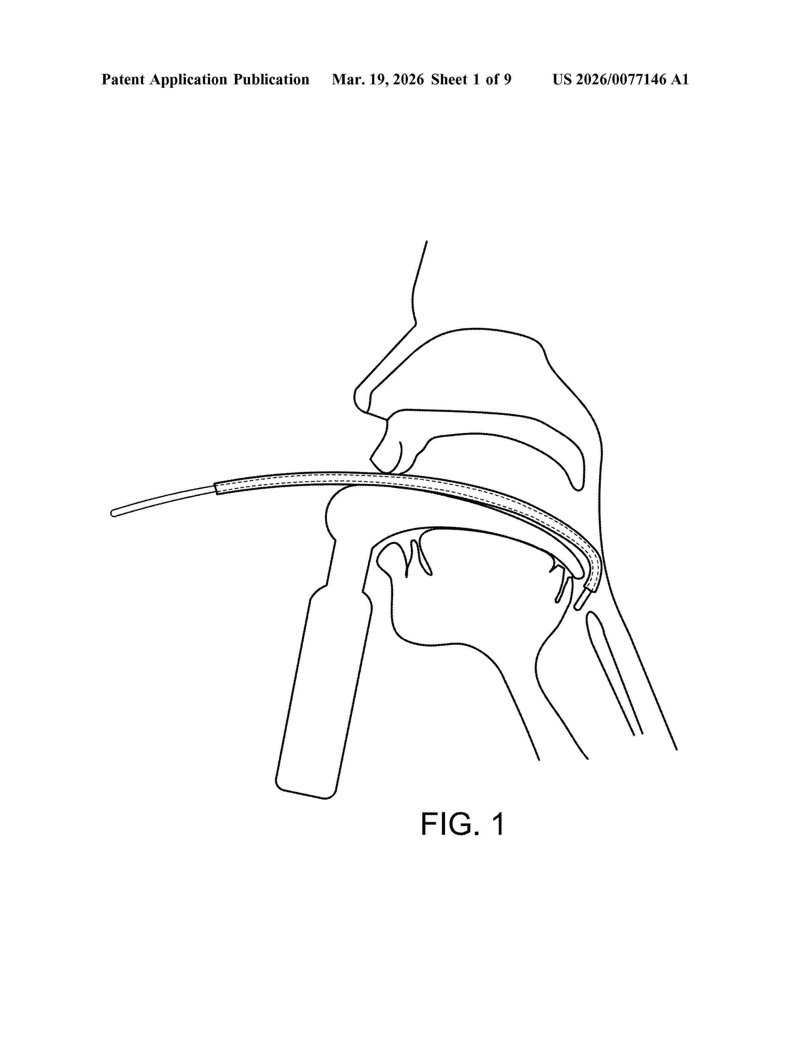 US_20260077146_A1