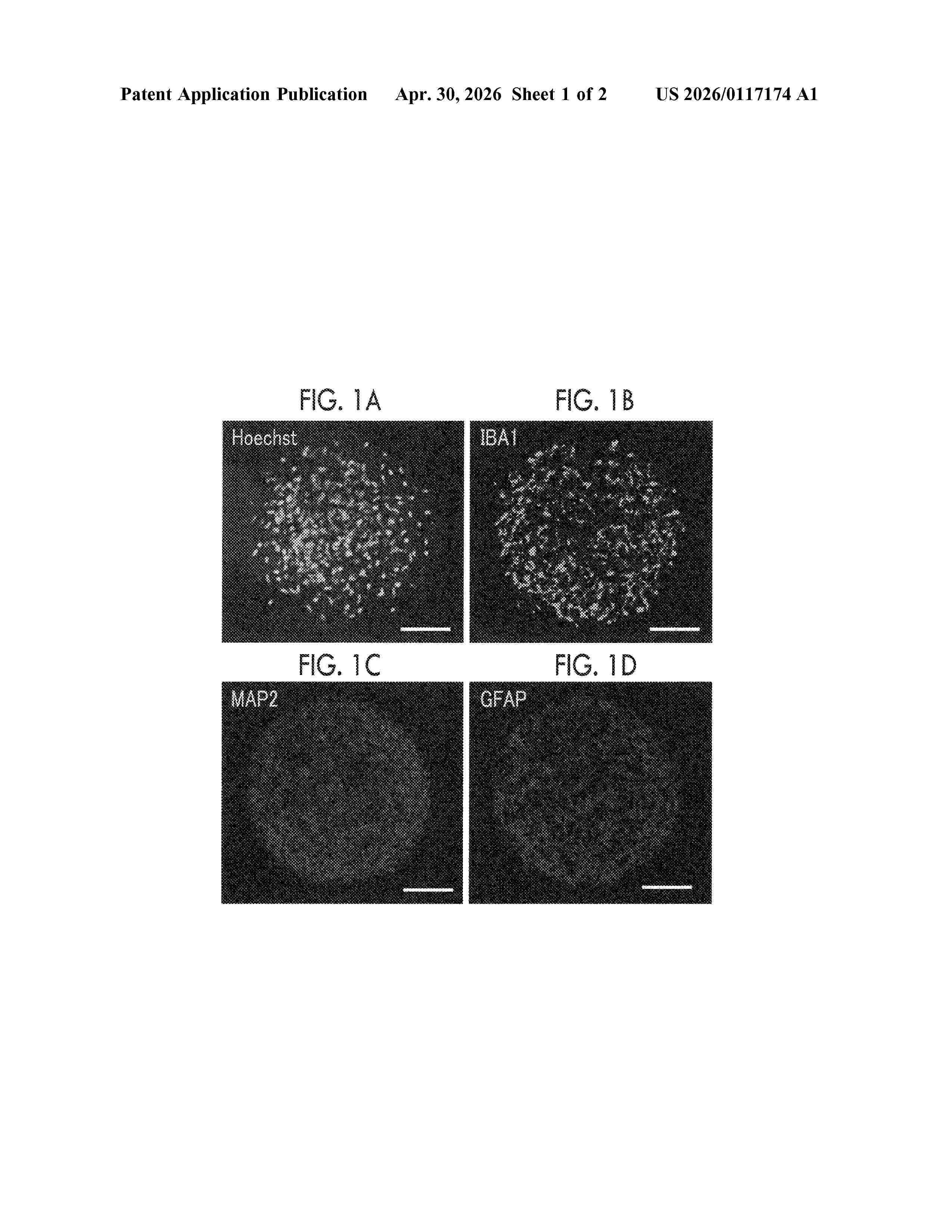 US_20260117174_A1