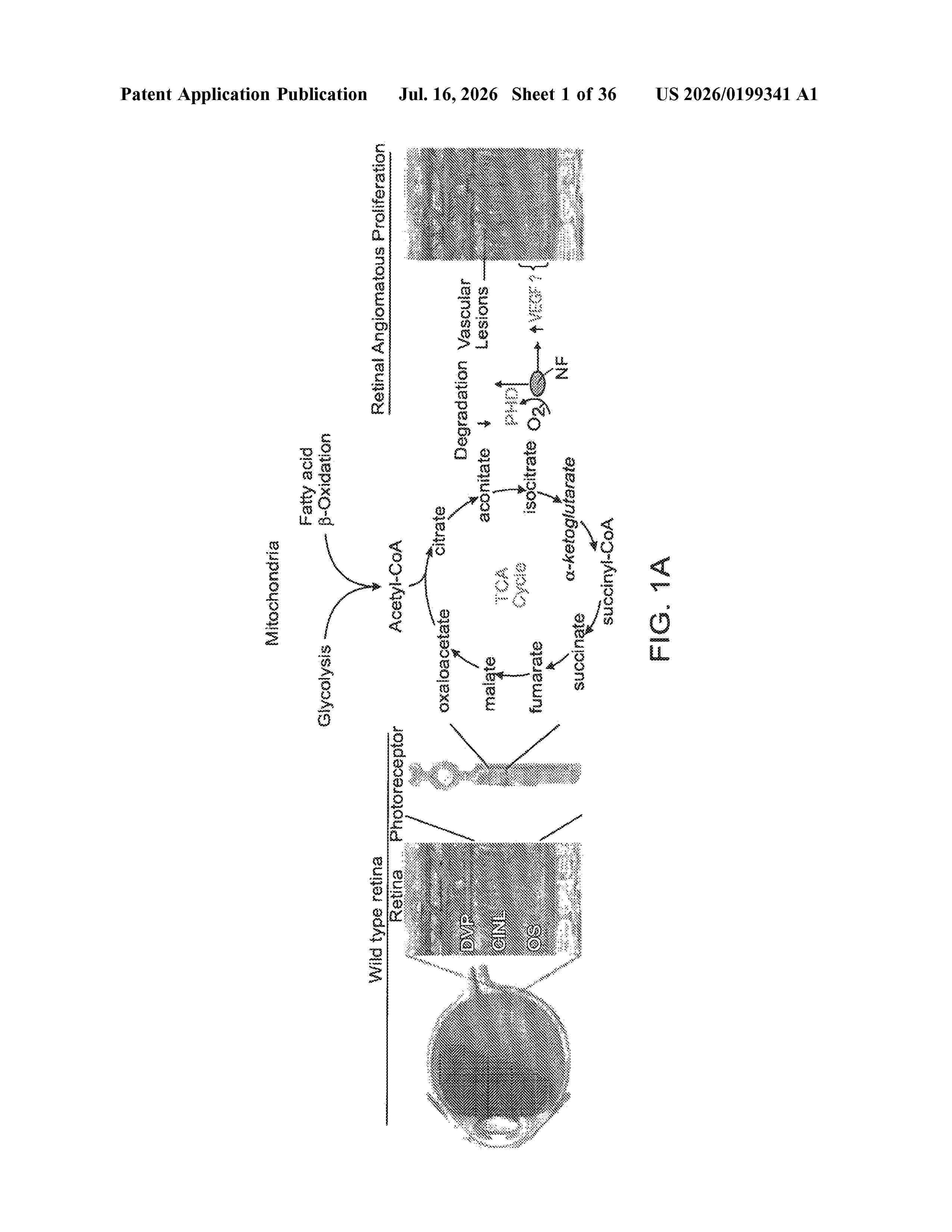 US_20260199341_A1