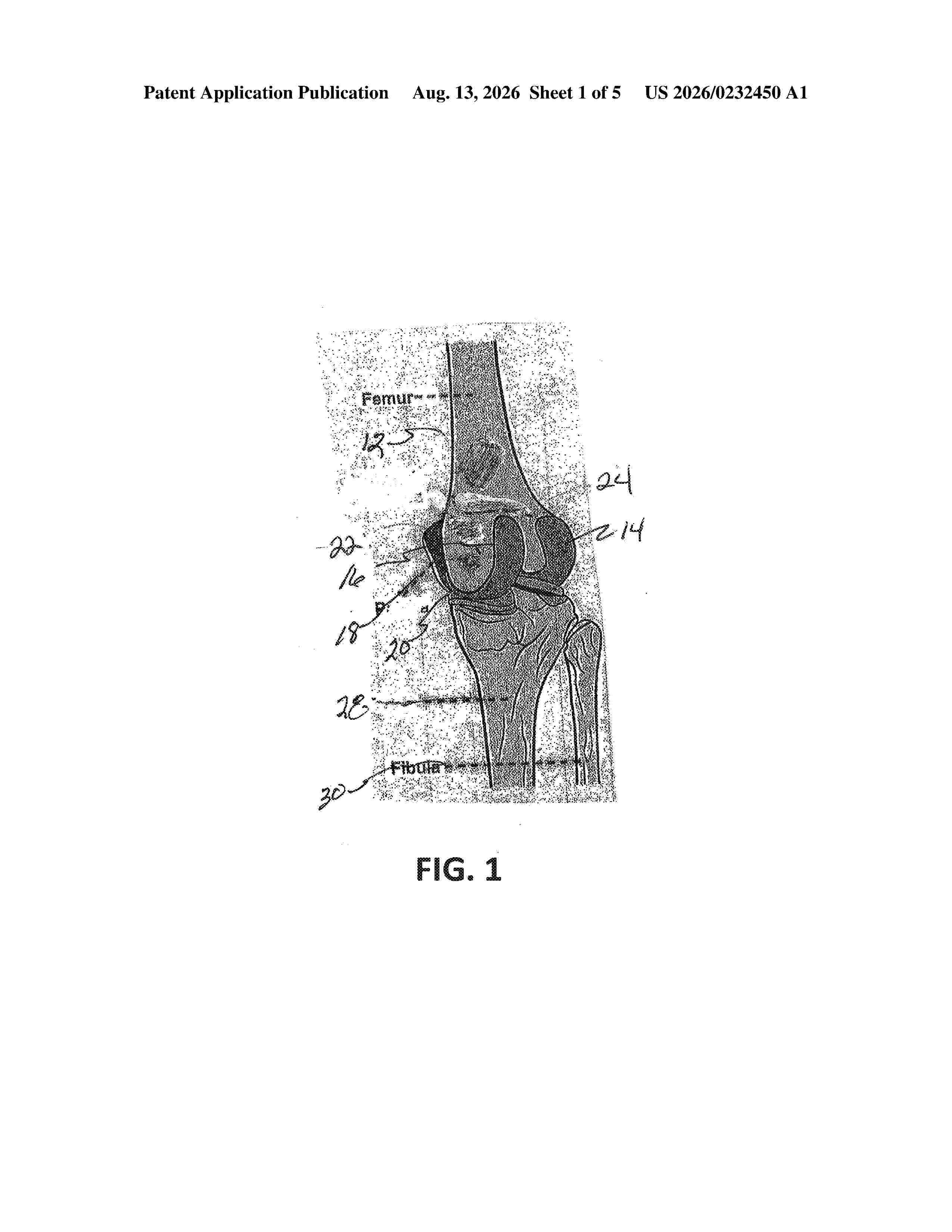 US_20260232450_A1