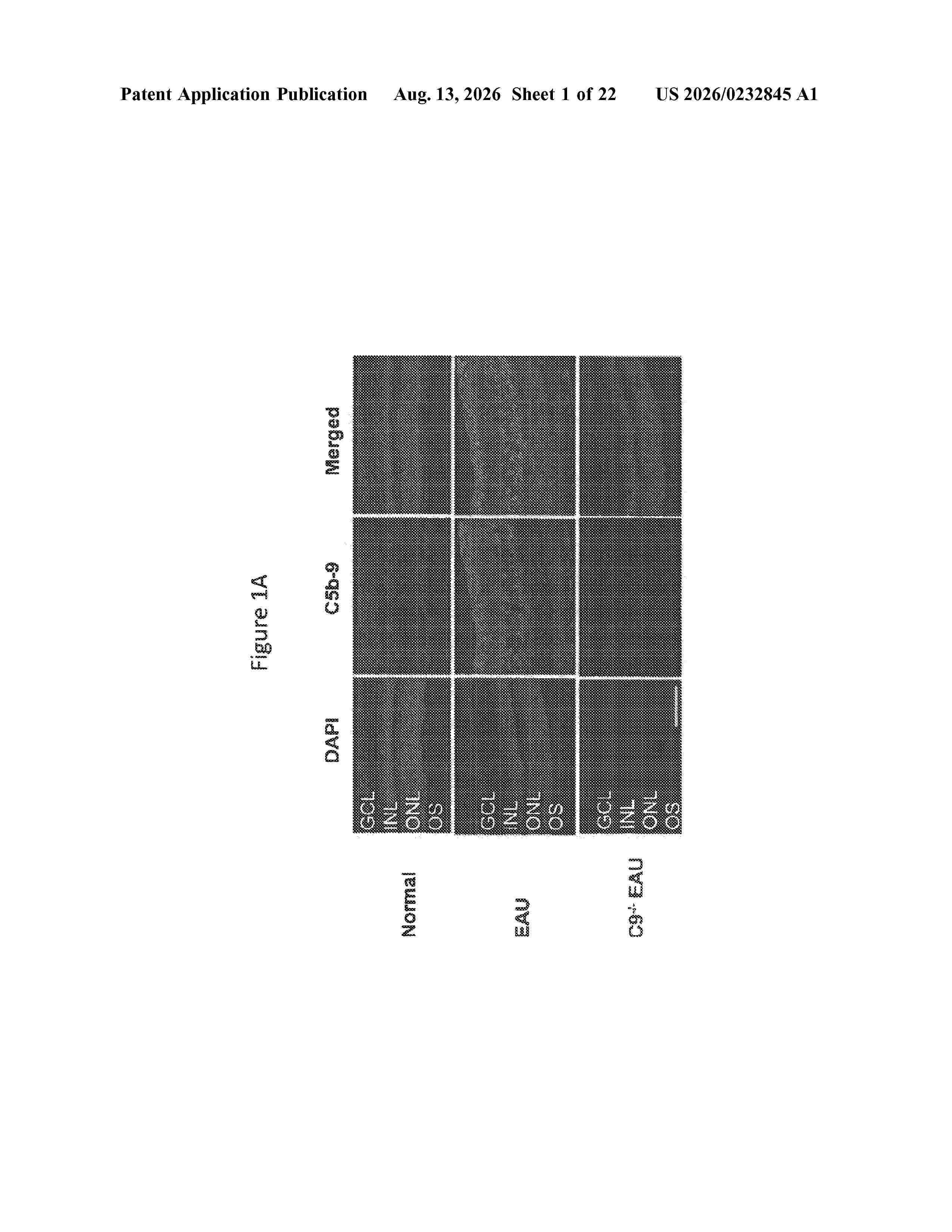 US_20260232845_A1