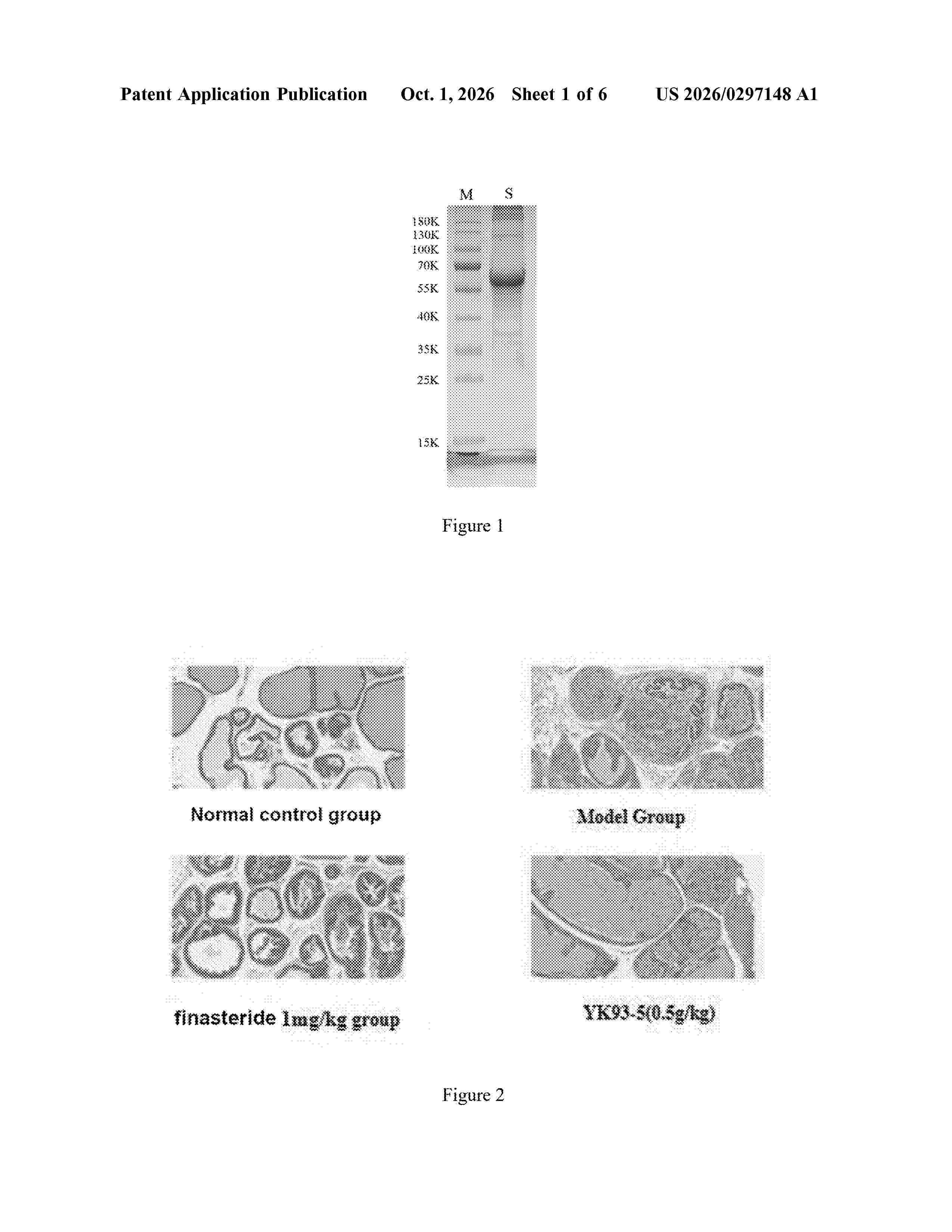 US_20260297148_A1