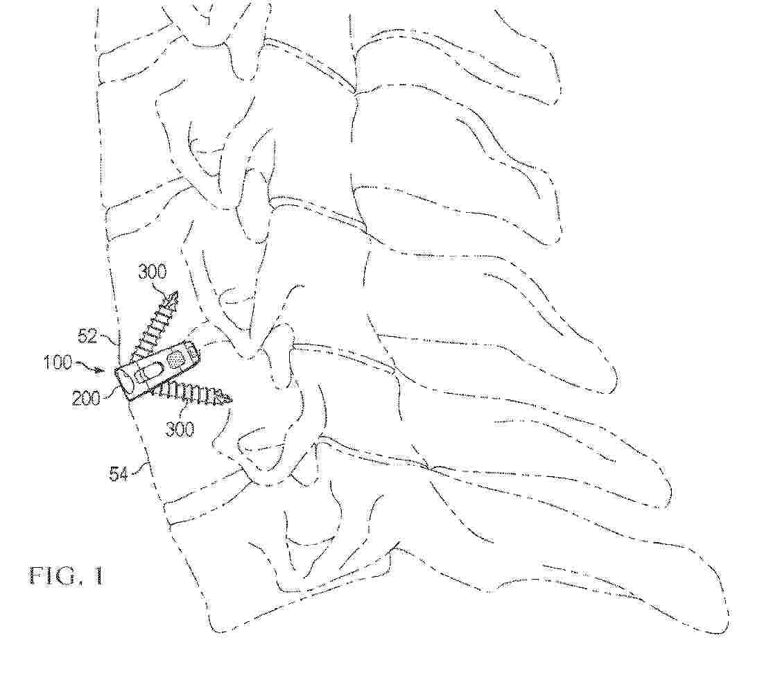 WO_2025064398_PA
