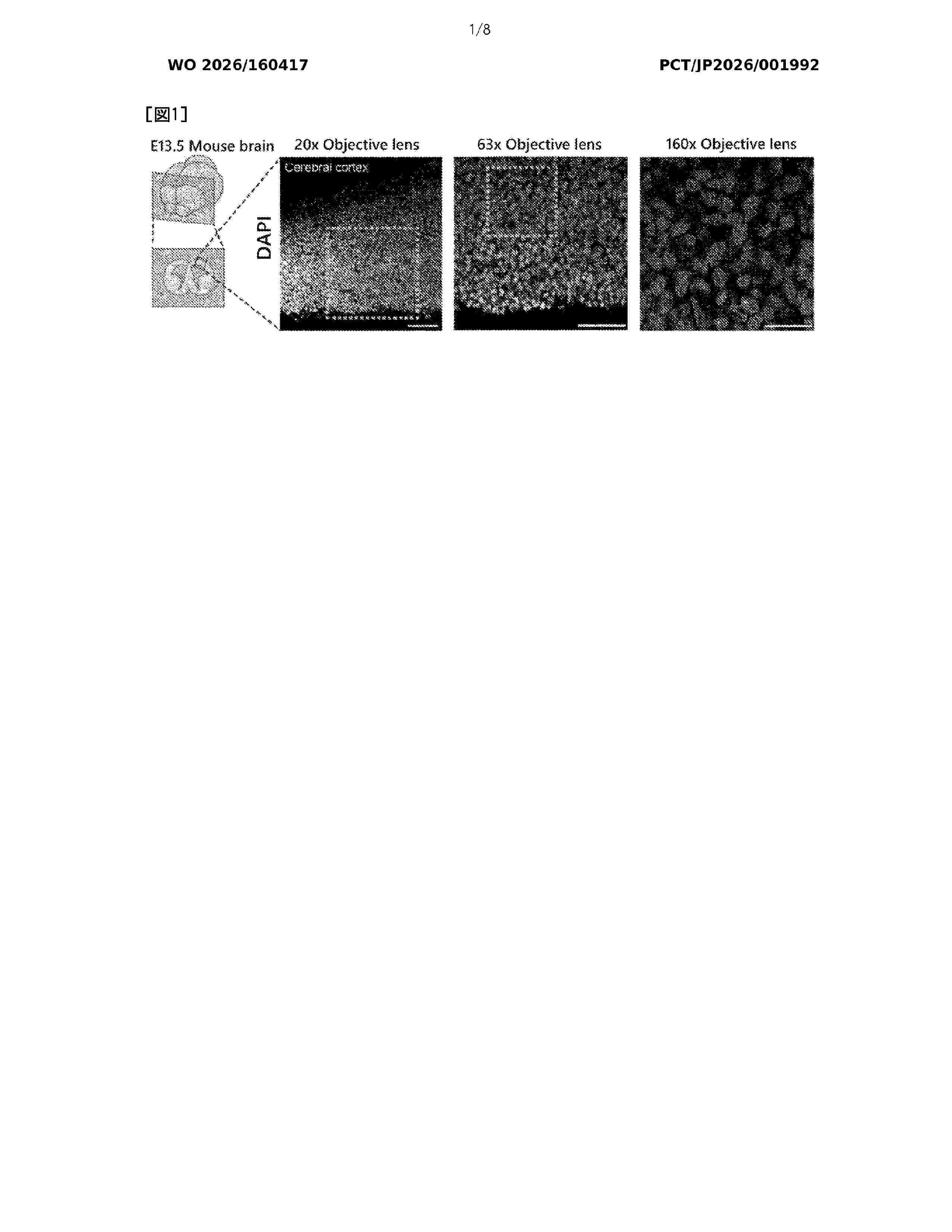 WO_2026160417_A1
