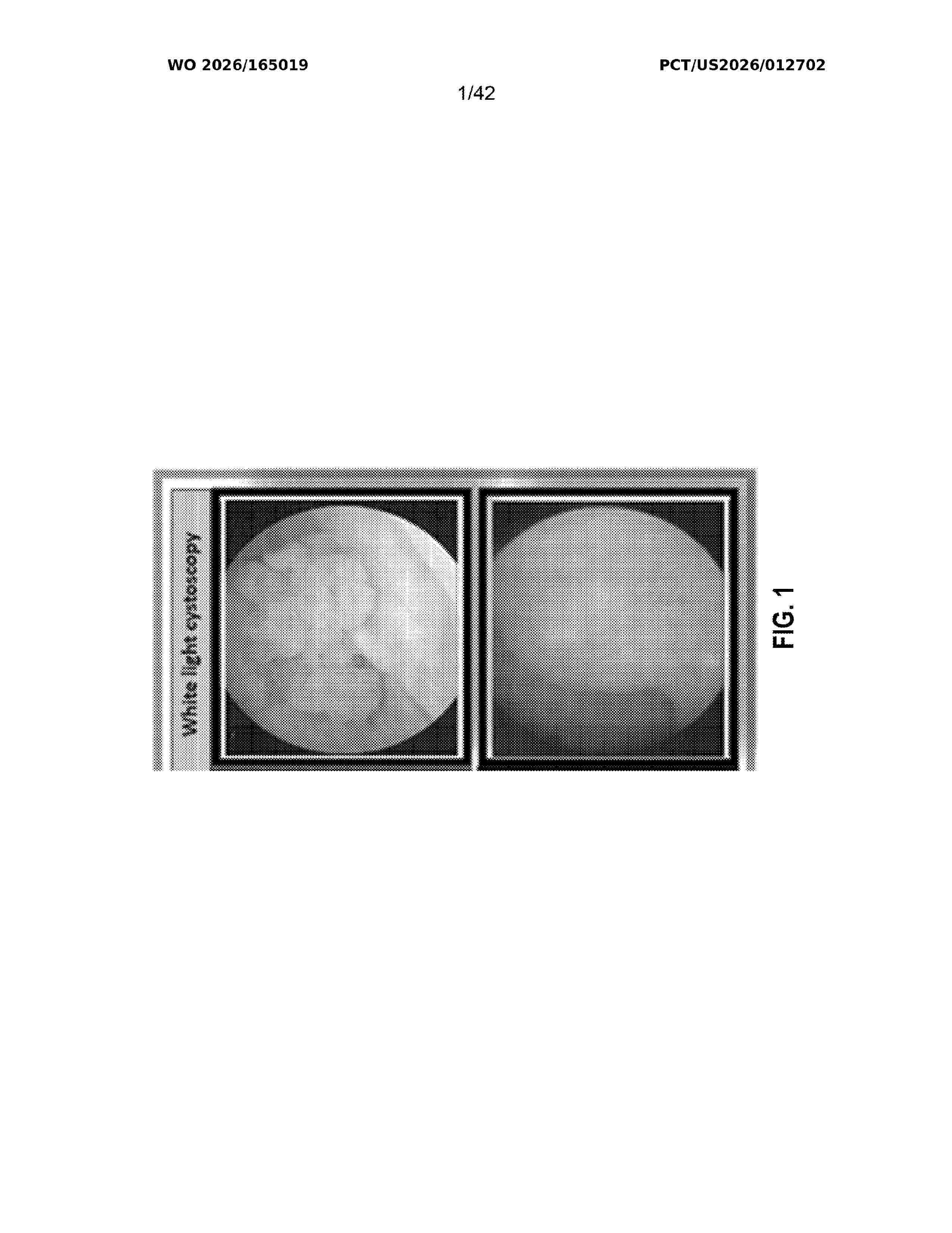 WO_2026165019_A1