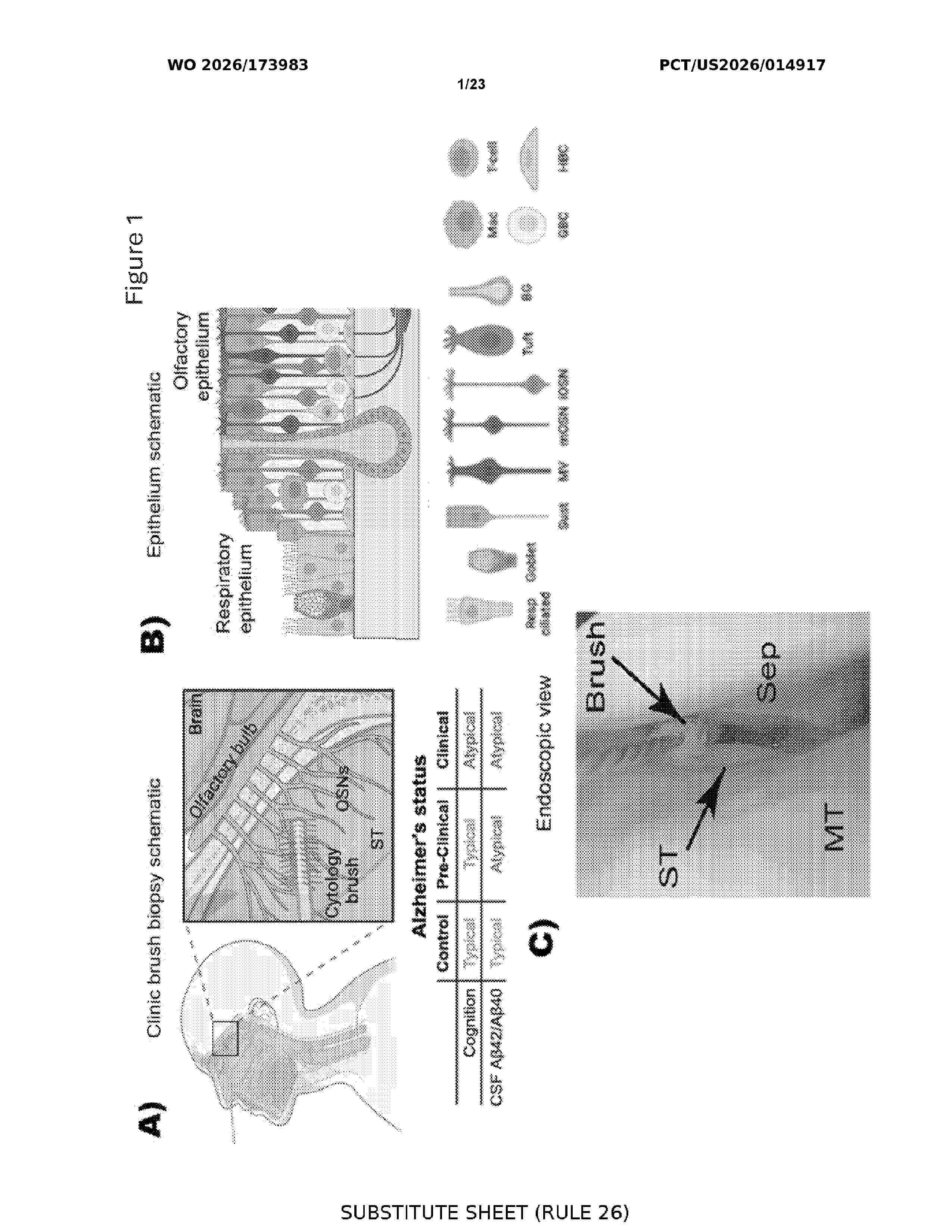 WO_2026173983_A1